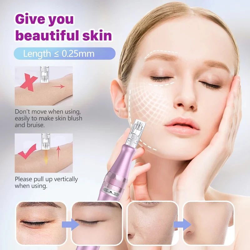 Velnora Skin Renew Microneedling Pen